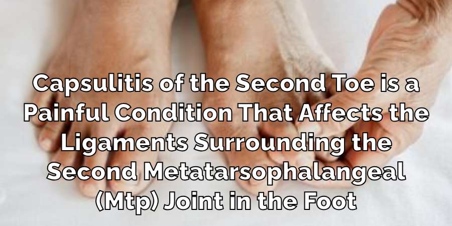 Capsulitis of the Second Toe is a
Painful Condition That Affects the
Ligaments Surrounding the
Second Metatarsophalangeal
(Mtp) Joint in the Foot