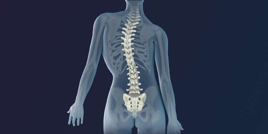 What is Scoliosis