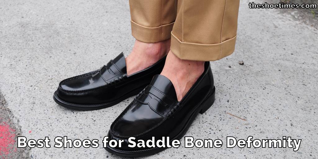 Best Shoes for Saddle Bone Deformity